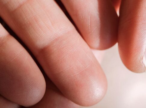 Your Fingerprints Disappear If Burned: 9 Skin Truths — Quick Facts trivia by TrivBits