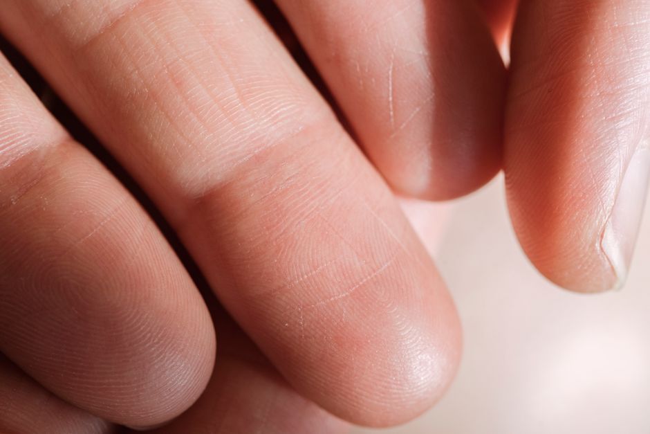 Your Fingerprints Disappear If Burned: 9 Skin Truths — Quick Facts trivia by TrivBits